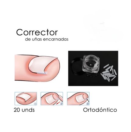 Corrector de uñas encarnadas